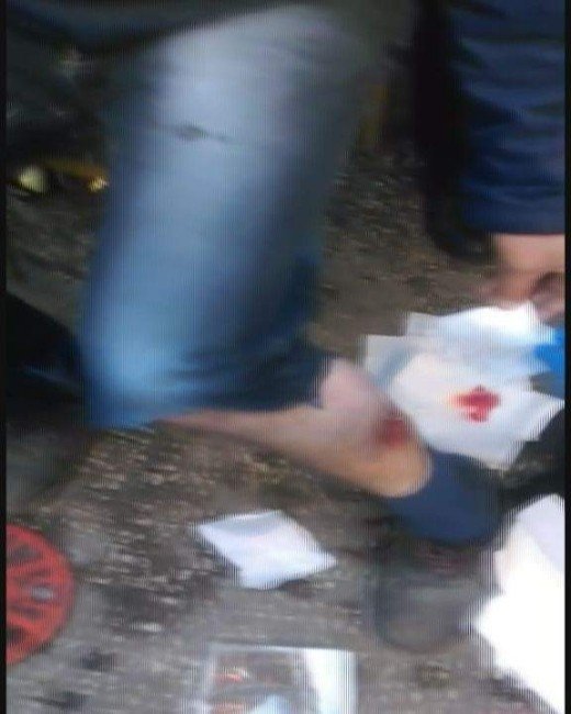 Bursa'da dehşet anları ! Pitbull bacağını parçaladı